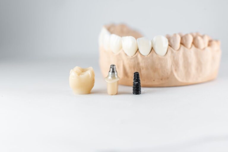 Model Of Artificial Jaw And Dental Implant Utc