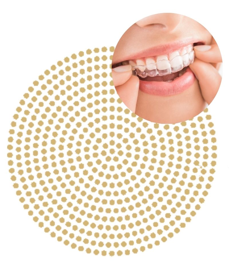 for invisalign page